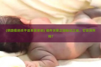 (鹤吻痕的孩子是来报恩的) 揭开天使之吻胎记之谜，它会消失吗？